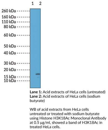 Anti-Histone H3K18Ac Monoclonal Antibody (RM166)