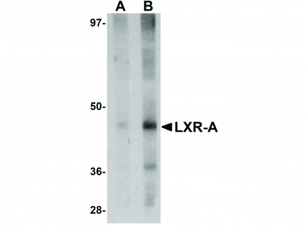 Anti-LXR-A