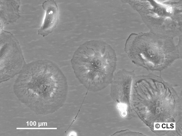 RCC-KP Cells