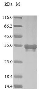 Myocilin (Myoc), partial, mouse, recombinant