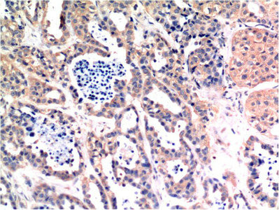 Anti-BAX Monoclonal