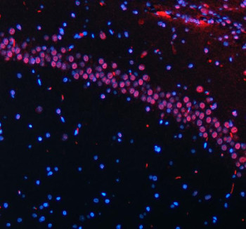 Anti-HTATSF1 / HIV Tat-specific factor 1