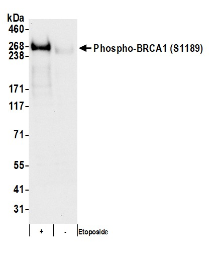Anti-phospho-BRCA1 (Ser1189)
