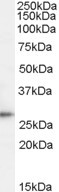 Anti-TPD52, C-terminal