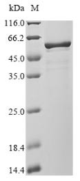Nucleoprotein (N), human coronavirus 229E, recombinant