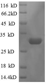 50S ribosomal protein L36 (rpmJ), Escherichia coli, recombinant