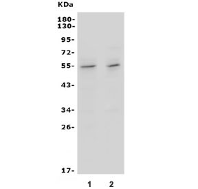 Anti-Ifngr2 / IFN gamma Receptor beta
