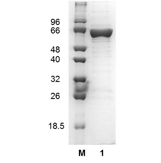 Acetyl-CoA synthetase (EC 6.2.1.1), Bacillus subtilis