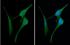 Anti-Cystatin B / Stefin B, clone 2F1