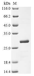 Fragile X mental retardation syndrome-related protein 1 (FXR1), partial, human, recombinant