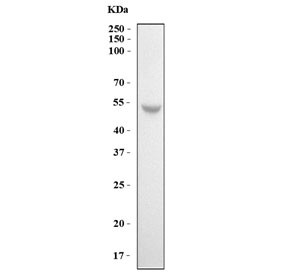 Anti-MMP13 / Collagenase 3