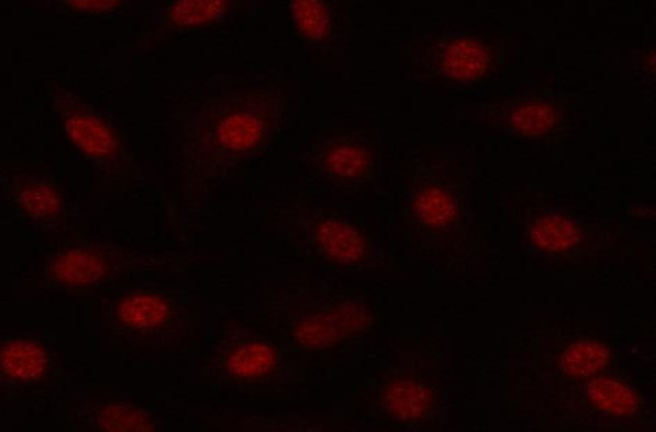 Anti-PRPF19