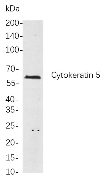 Anti-Recombinant Cytokeratin 5, clone 2B13