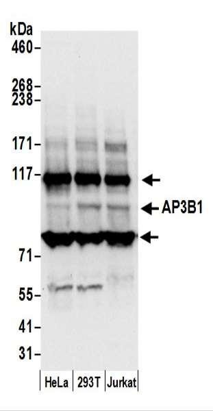 Anti-AP3B1