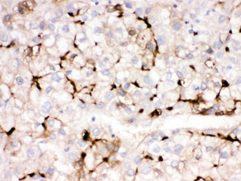 Anti-Apolipoprotein A1