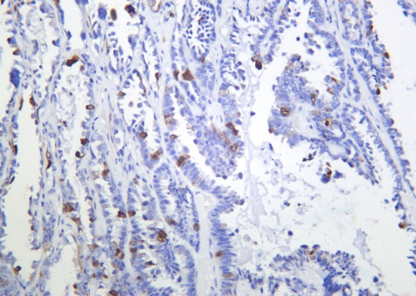 Anti-Recombinant Phospho-CDK1, 2 (Thr14), clone 6H6