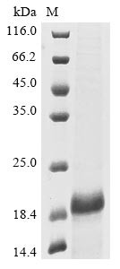 Metallothionein-3 (Mt3), mouse, recombinant