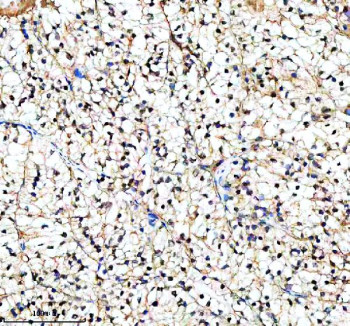 Anti-PIF1 / ATP-dependent DNA helicase PIF1