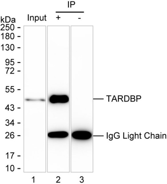 Anti-TDP-25 / TDP-35 / TDP-43