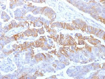 Anti-E-Cadherin (CDH1) / CD324 (Intercellular Junction Marker) Recombinant Mouse Monoclonal Antibody