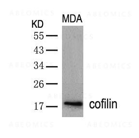 Anti-cofilin (Ab-3)