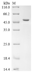 Primary amine oxidase, lung isozyme,partial, bovine, recombinant