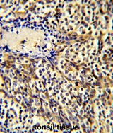 Anti-CCL3 / MIP1 alpha