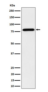 Anti-PRMT7 / Protein arginine methyltransferase 7, clone 29P93