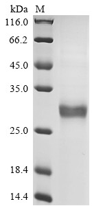 Ancylostoma secreted protein 2 (ASP2), Necator americanus, recombinant