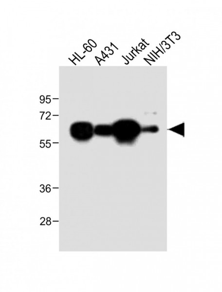 Anti-METTL14