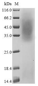 Beta-enolase (Eno3), mouse, recombinant