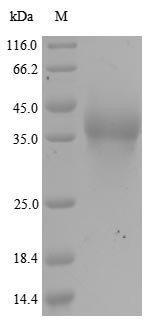 E3 SUMO-protein ligase RanBP2 (RANBP2), partial, human, recombinant