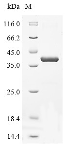 Collagen triple helix repeat-containing protein 1 (Cthrc1), mouse, recombinant