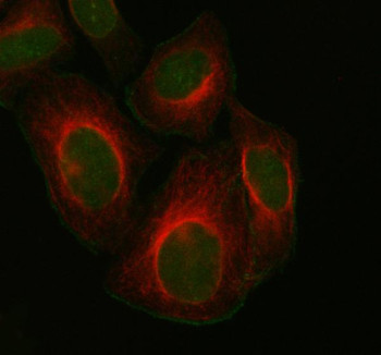 Anti-FOXM1 / Forkhead box protein M1