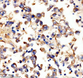 Anti-UPF1 / Up-frameshift suppressor 1 / RENT1, clone 19U80