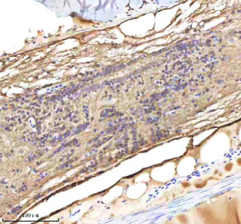 Anti-Danre Lmo2 / Rhombotin 2