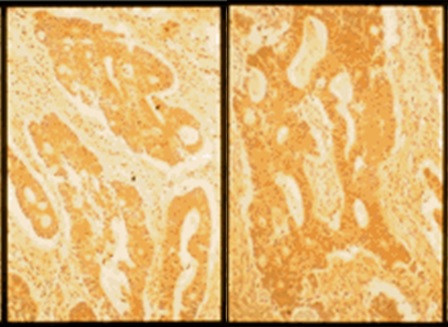 Anti-Fibronectin, clone FN12-8