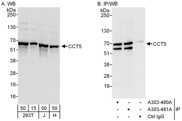Anti-CCT5