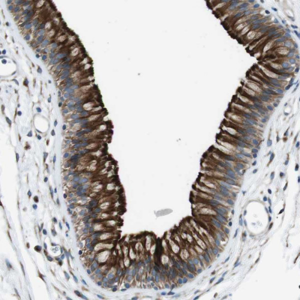 Anti-CDH26