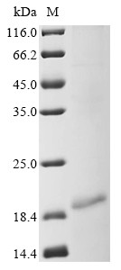 Myosin-7 (MYH7), partial, human, recombinant
