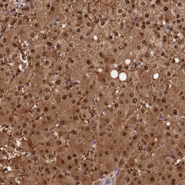 Anti-ACP7