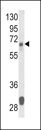 Anti-Glutaminase