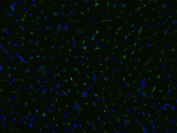 Anti-CD105, clone MEM-229