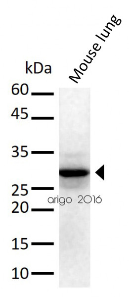 Anti-14-3-3 sigma / Stratifin, Internal