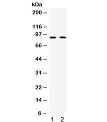 Anti-CIP2A / KIAA1524