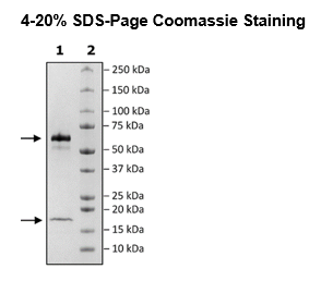 PCSK9, His-tag