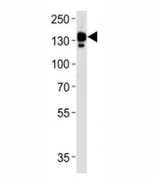 Anti-Ceruloplasmin