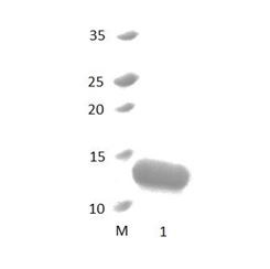 PDZD11 PDZ Domain