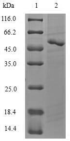 Serine/threonine-protein kinase ATG1 (ATG1), partial, Candida glabrata, recombinant