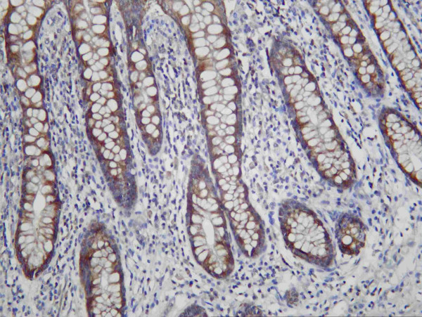 Anti-Recombinant LYPLA1, clone C112272